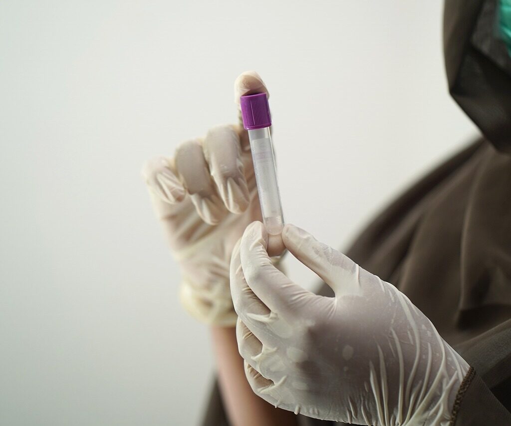 blood test, blood sample, medical technology